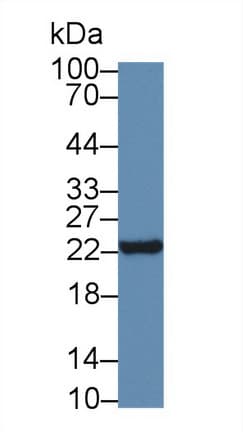 NTS / NT / Neurotensin Antibody (aa42-167)