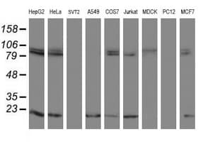 TPRKB Antibody (clone OTI3H3)
