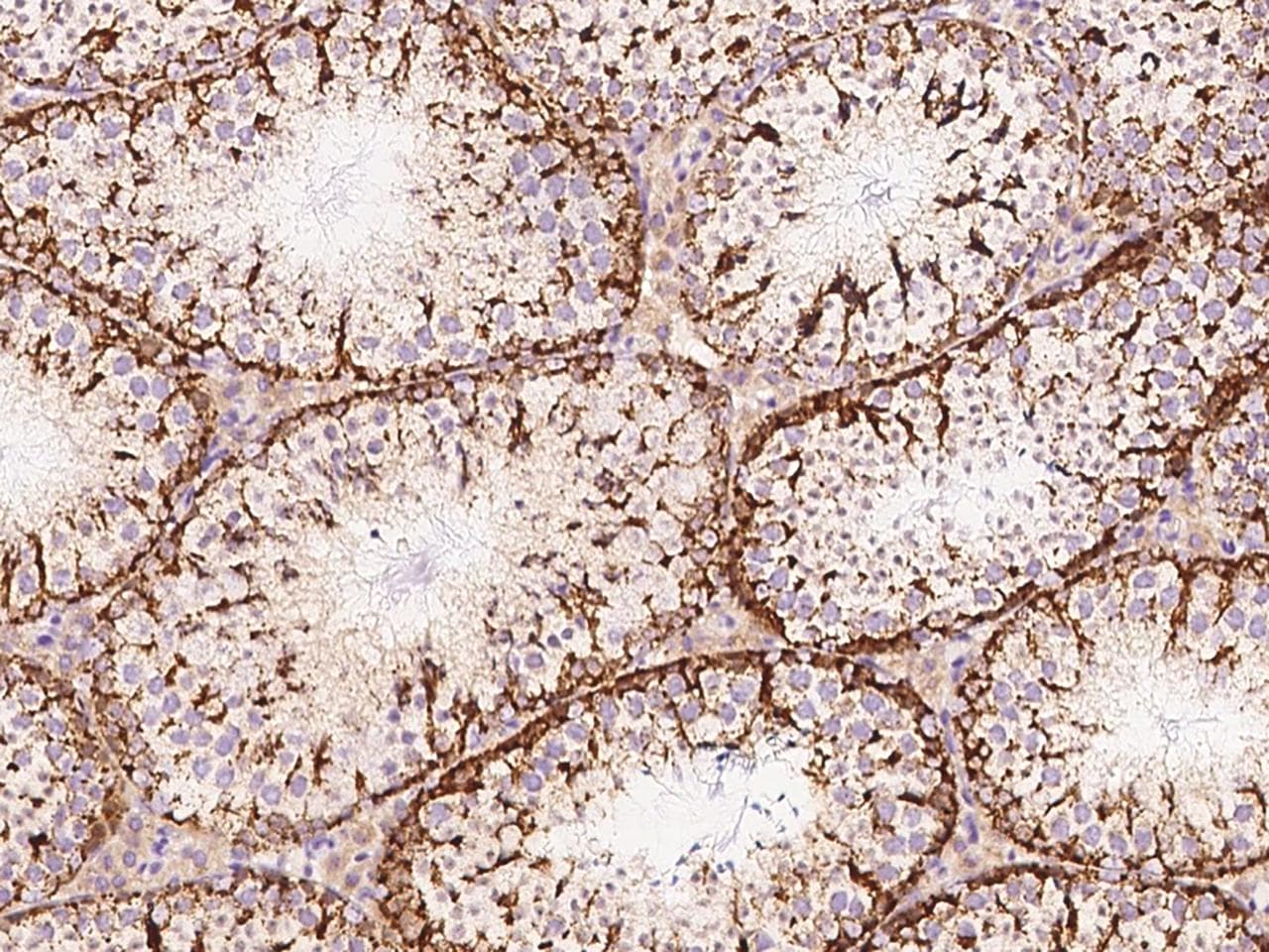 Polyclonal Rabbit anti-Mouse MIA40 / CHCHD4 Antibody (Preservative Free, IHC)