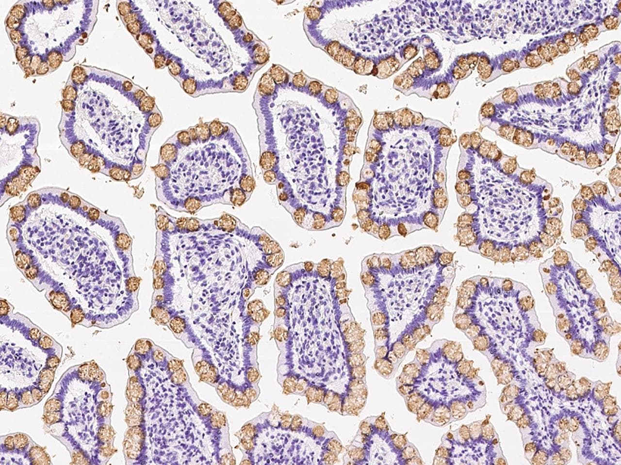 Polyclonal Rabbit anti-Human GOB5 / CLCA1 Antibody (IHC)