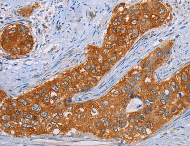 Polyclonal Rabbit anti-Human MMP1 Antibody (IHC)