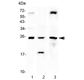 TIMP4 Antibody