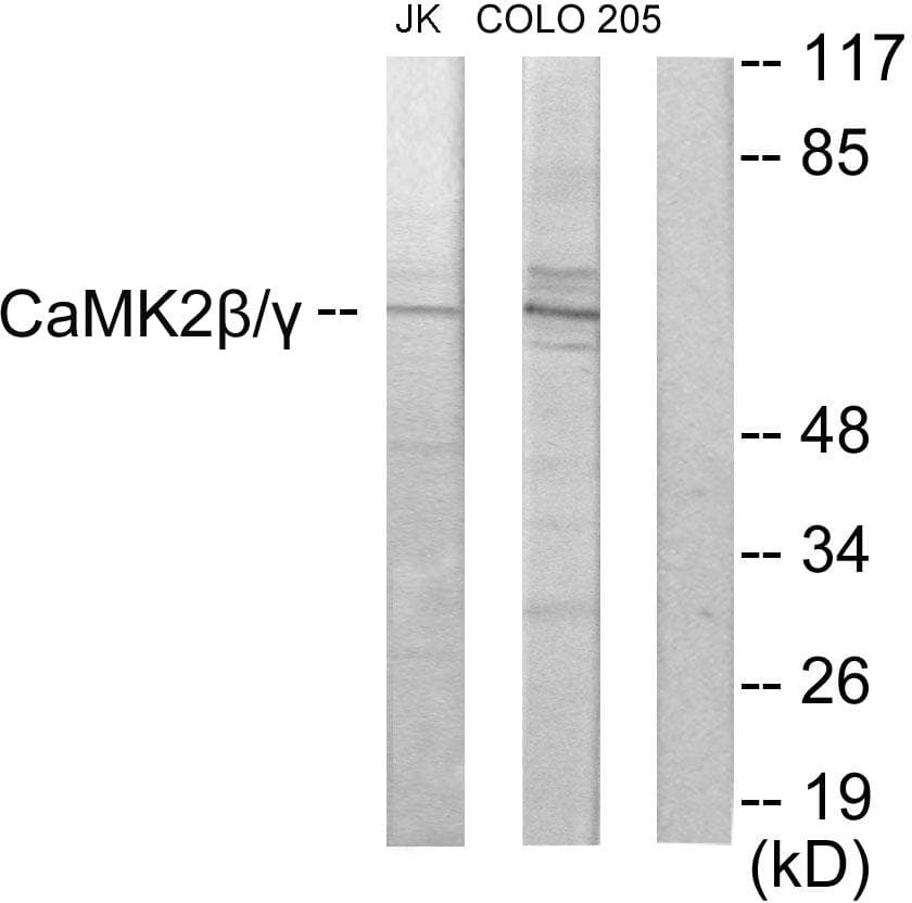 Polyclonal Rabbit anti-Human CaMKII Beta+Gamma Antibody (IHC, WB)