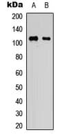 Polyclonal Rabbit anti-Human KSR1 Antibody (Internal, IHC, IF, WB)