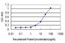 TP53BP1 / 53BP1 Antibody (clone 1B9)
