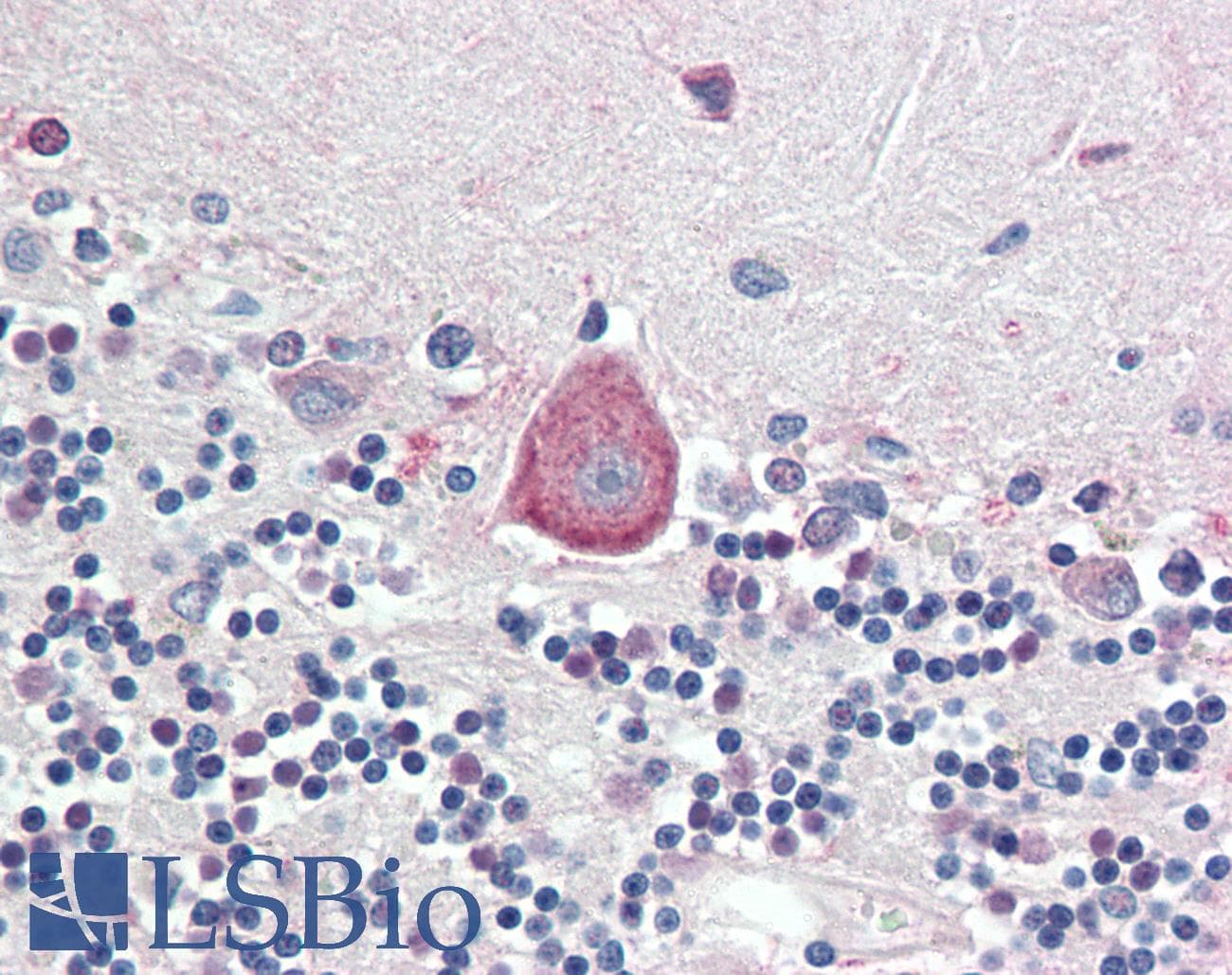 IHC-plus™ HOXA10 Antibody (aa152-165)