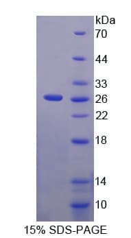 Mouse C6orf150 / MB21D1 Protein (Recombinant His-T7)