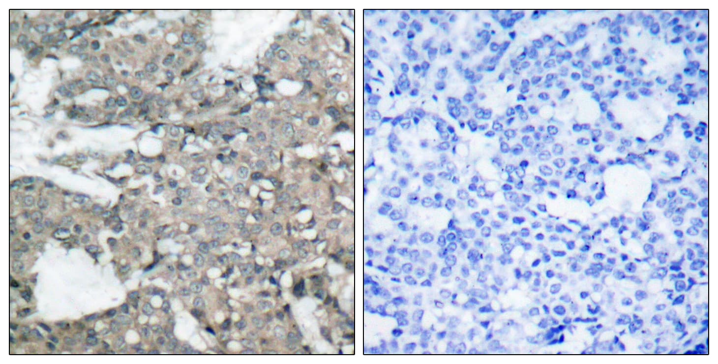 Polyclonal Rabbit anti-Human MEK1 + MEK2 Antibody (aa193-242, IHC, WB)