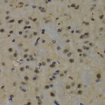 Polyclonal Rabbit anti-Human PTEN Antibody (IHC, WB)