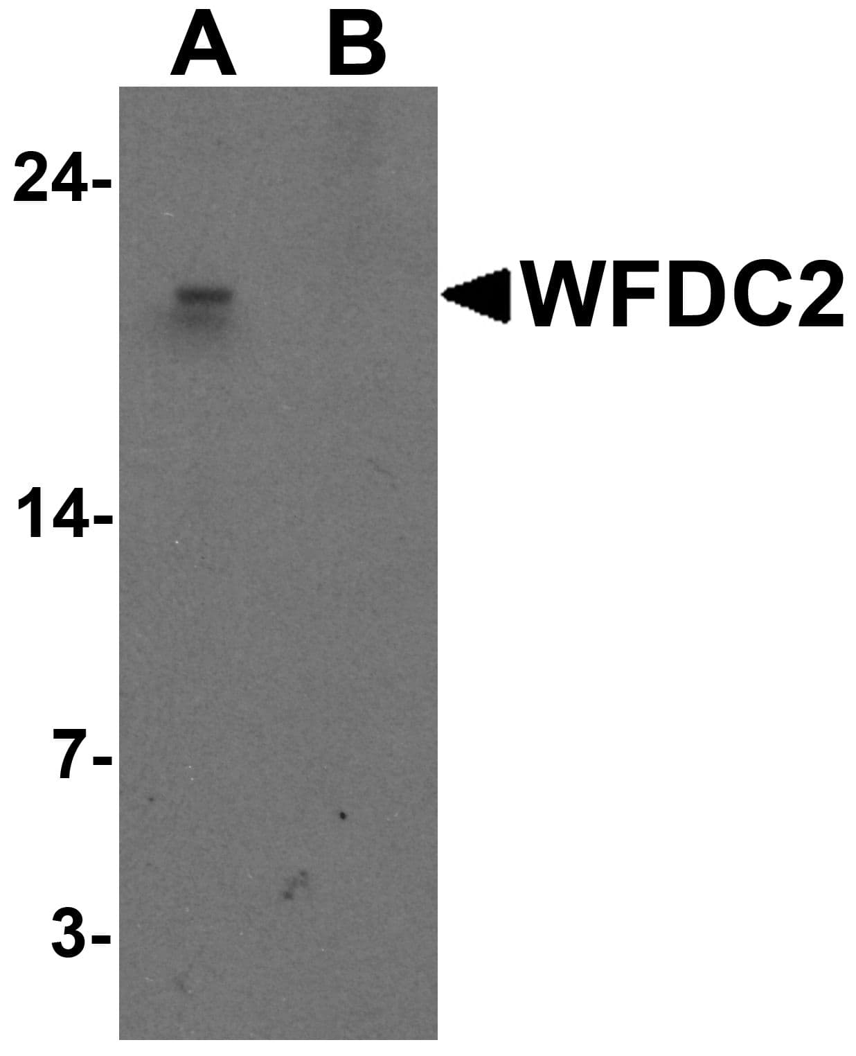 Polyclonal Rabbit anti-Human WFDC2 / HE4 Antibody (IHC, IF, WB)