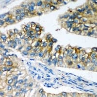 Polyclonal Rabbit anti-Human SLC4A4 / NBC1 Antibody (IHC, WB)