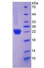 Mouse COL6A1 / Collagen VI Alpha 1 Protein (Recombinant His)