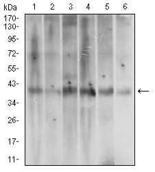 ACP5 / TRAP Antibody (aa221-325, clone 7E6A11)