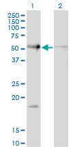 Monoclonal Mouse anti-Human RAD23B / HR23B Antibody (clone 3H7, WB)