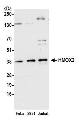 HMOX2 / Heme Oxygenase 2 Antibody (aa225-275)