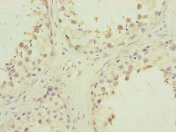 Polyclonal Rabbit anti-Human PMPCB / MPP11 Antibody (IHC, WB)