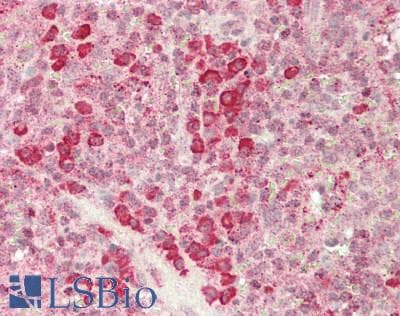 IHC-plus™ Polyclonal Rabbit anti-Human SGSH Antibody (IHC, WB)