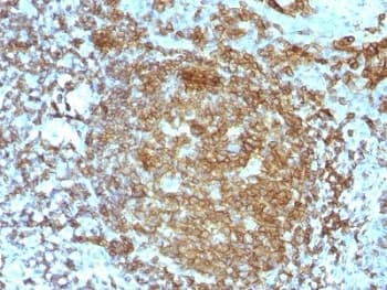 CD45RA Antibody (clone PTPRC/818)