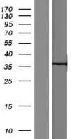 KCNIP2 / KCHIP2 Protein (Over-Expression Lysate Myc-DDK (Flag))