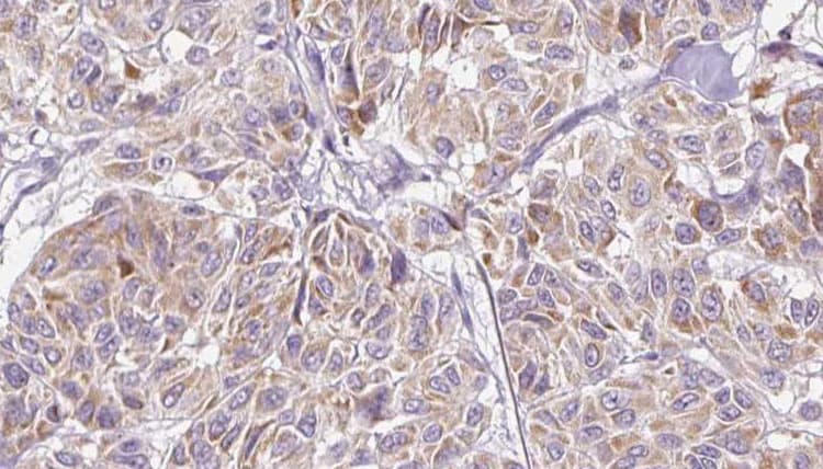CCL11 / Eotaxin Antibody