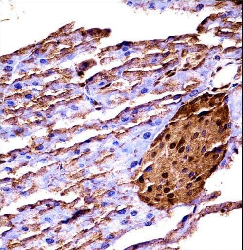 MAP3K2 / MEKK2 Antibody (aa14-43)