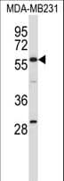 Polyclonal Rabbit anti-Human Testilin / EHD1 Antibody (aa410-438, WB)