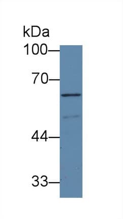 ACVR1C / ALK7 Antibody (aa21-493, Biotin)