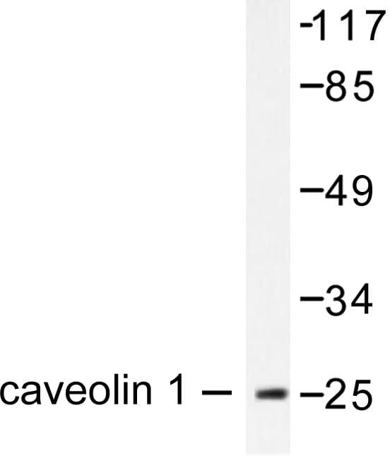 CAV1 / Caveolin 1 Antibody (Val163)