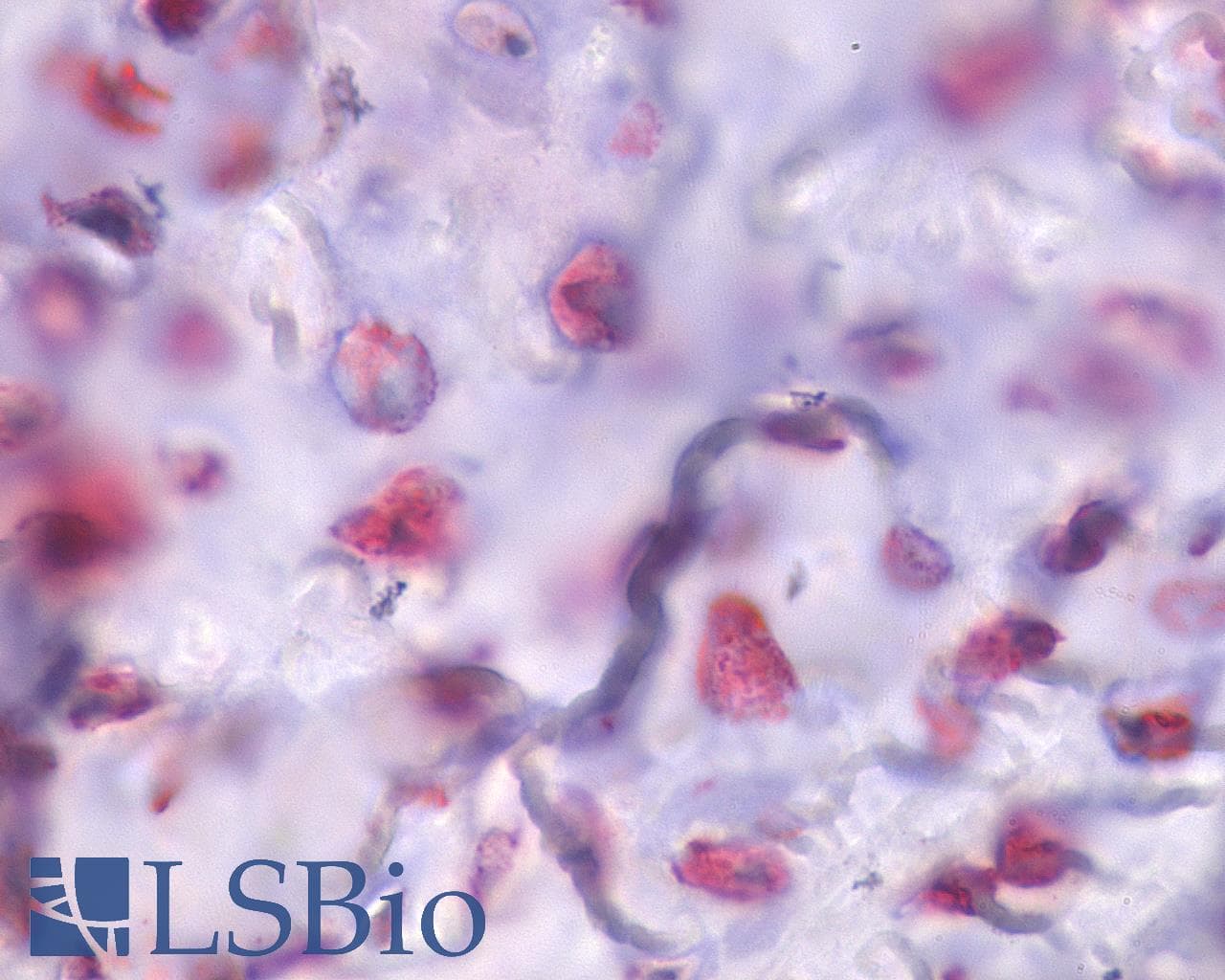 IHC-plus™ PTHR / PTHR1 Antibody (Internal)