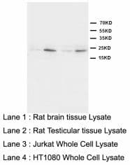 HMGB4 Antibody (N-Terminus)