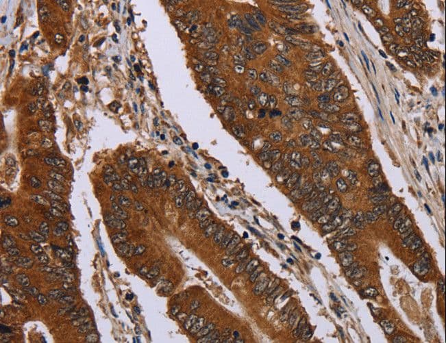 JUP/CTNNG/Junction Plakoglobin Antibody
