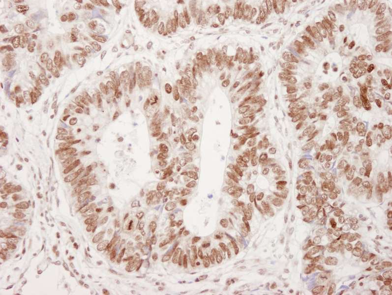 TP53BP1 / 53BP1 Antibody (phospho-Ser25)