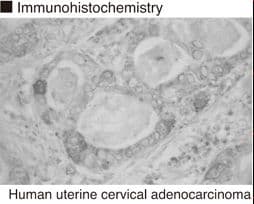 EBAG9 / RCAS1 Antibody (clone 22-1-1)
