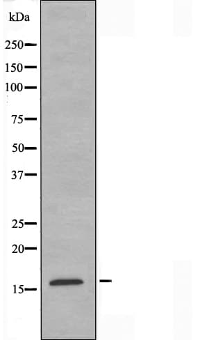 RPS19 / Ribosomal Protein S19 Antibody