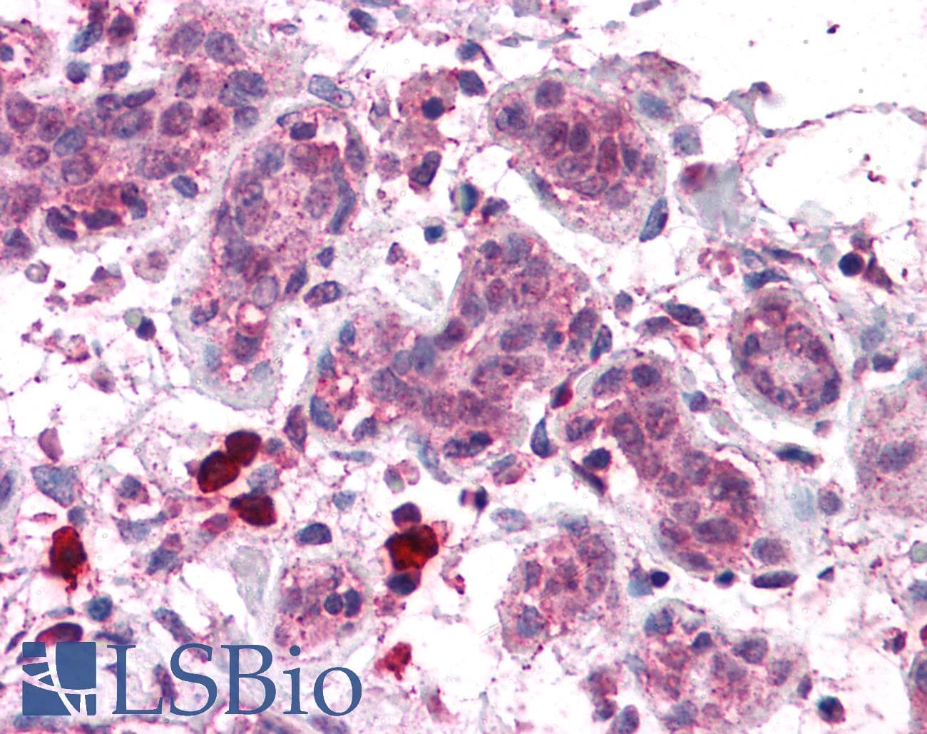 IHC-plus™ COPS8 / COP9 Antibody