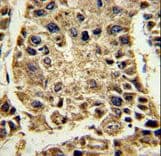 Polyclonal Rabbit anti-Human SERPINA4 / Kallistatin Antibody (aa291-320, IHC, WB)