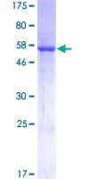 Human TS / Thymidylate Synthase Protein (Recombinant GST)