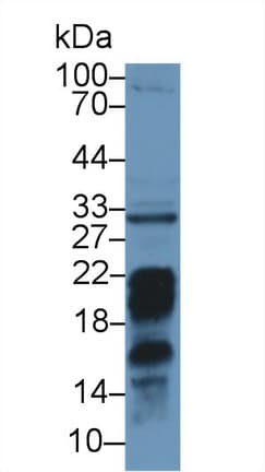 PD-L2 / PDCD1LG2 / CD273 Antibody (aa36-219)