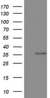 OTC Antibody (aa33-354, clone OTI3H4)