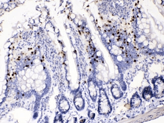 AKR1B1 / Aldose Reductase Antibody