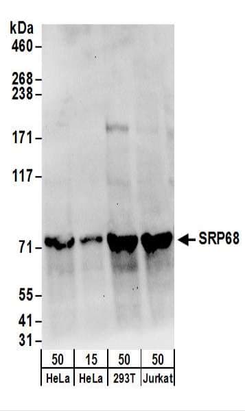 Polyclonal Rabbit anti-Human SRP68 Antibody (aa1-50, WB)
