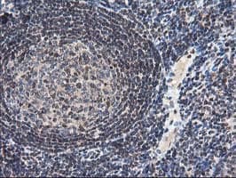 NUDT18 Antibody (clone OTI5D7)