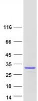 Human TGIF2LY Protein (Recombinant Myc-DDK (Flag))