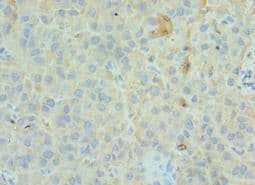 GC / Vitamin D-Binding Protein Antibody (aa305-474)