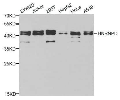 Polyclonal Rabbit anti-Human HNRNPD / AUF1 Antibody (IHC, WB)