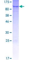 Human SGSM3 Protein (Recombinant GST)