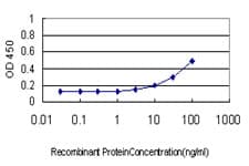 AKT1 Antibody (clone 2E11)