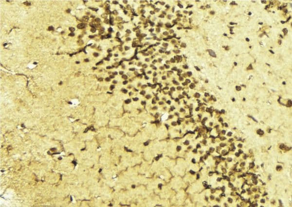 TFAP2A / AP-2 Antibody