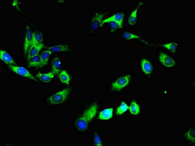 SYVN1 / HRD1 Antibody