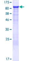Human ITPKC Protein (Recombinant GST)